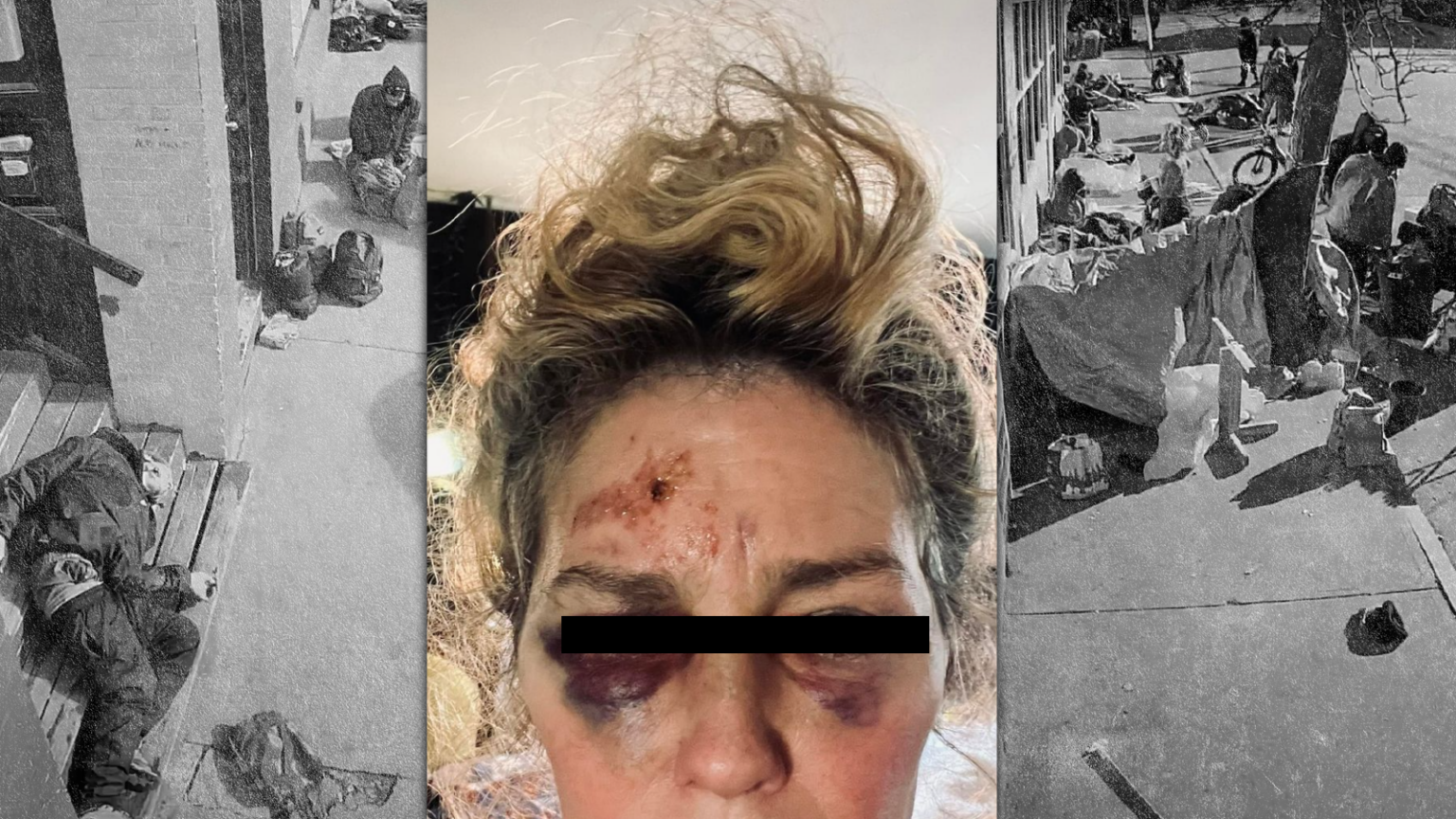 Longtime Bayside Resident Says She was Victim of Brutal Mugging, Warns Women not to Walk Alone in Neighborhood