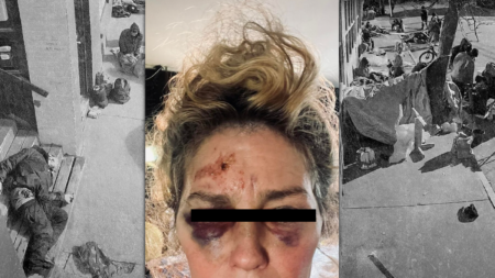 Longtime Bayside Resident Says She was Victim of Brutal Mugging, Warns Women not to Walk Alone in Neighborhood