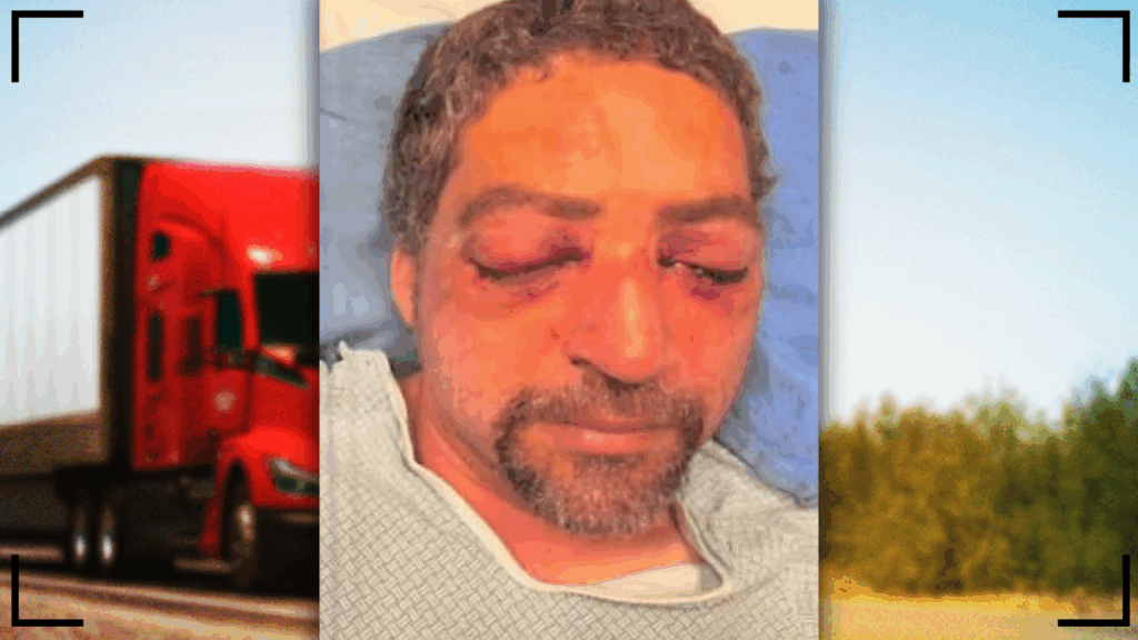New England Road Rager Attacks Trucker, Gouges Eyes, In Vicious Assault