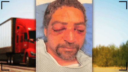 New England Road Rager Attacks Trucker, Gouges Eyes, In Vicious Assault